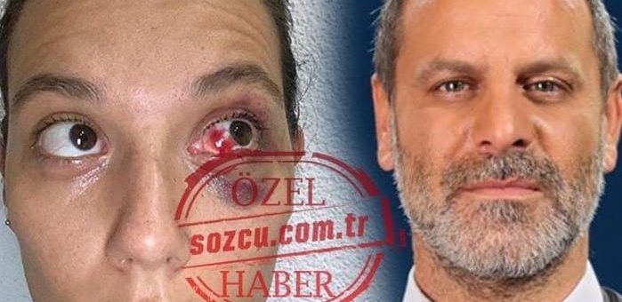 Ozan Güven VS Deniz Bulutsuz